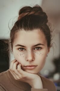 Acne Scars Treatment