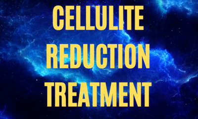 RF skin tightening devices