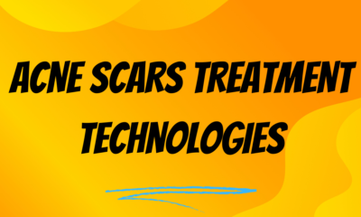 Acne Scars Treatment
